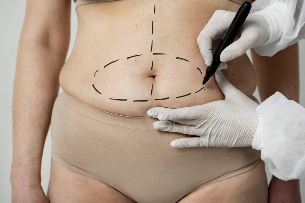 Abdominoplasty Recovery Time
