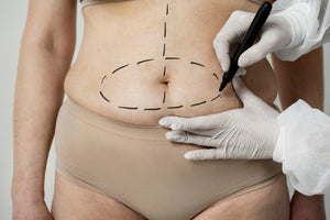 Abdominoplasty Recovery Time