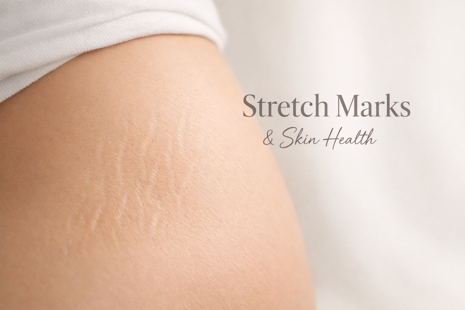 Beauty Consciousness and Stretch Marks: Causes & Treatment Options